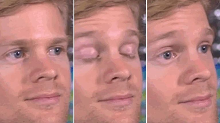 Plantilla de meme Blinking White Guy