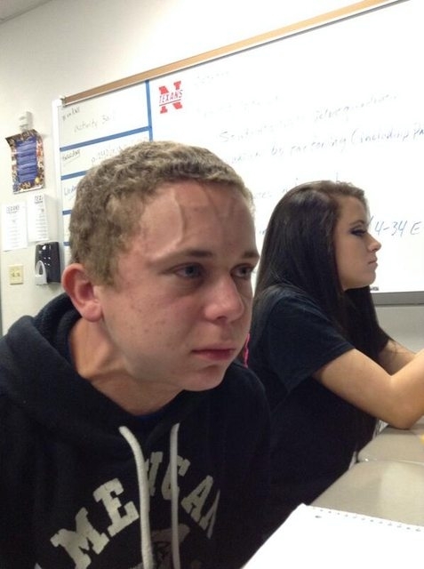 Plantilla de meme Bulging Forehead Vein