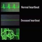 heart monitor meme template