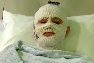 Template meme hospital bed survivor burn victim