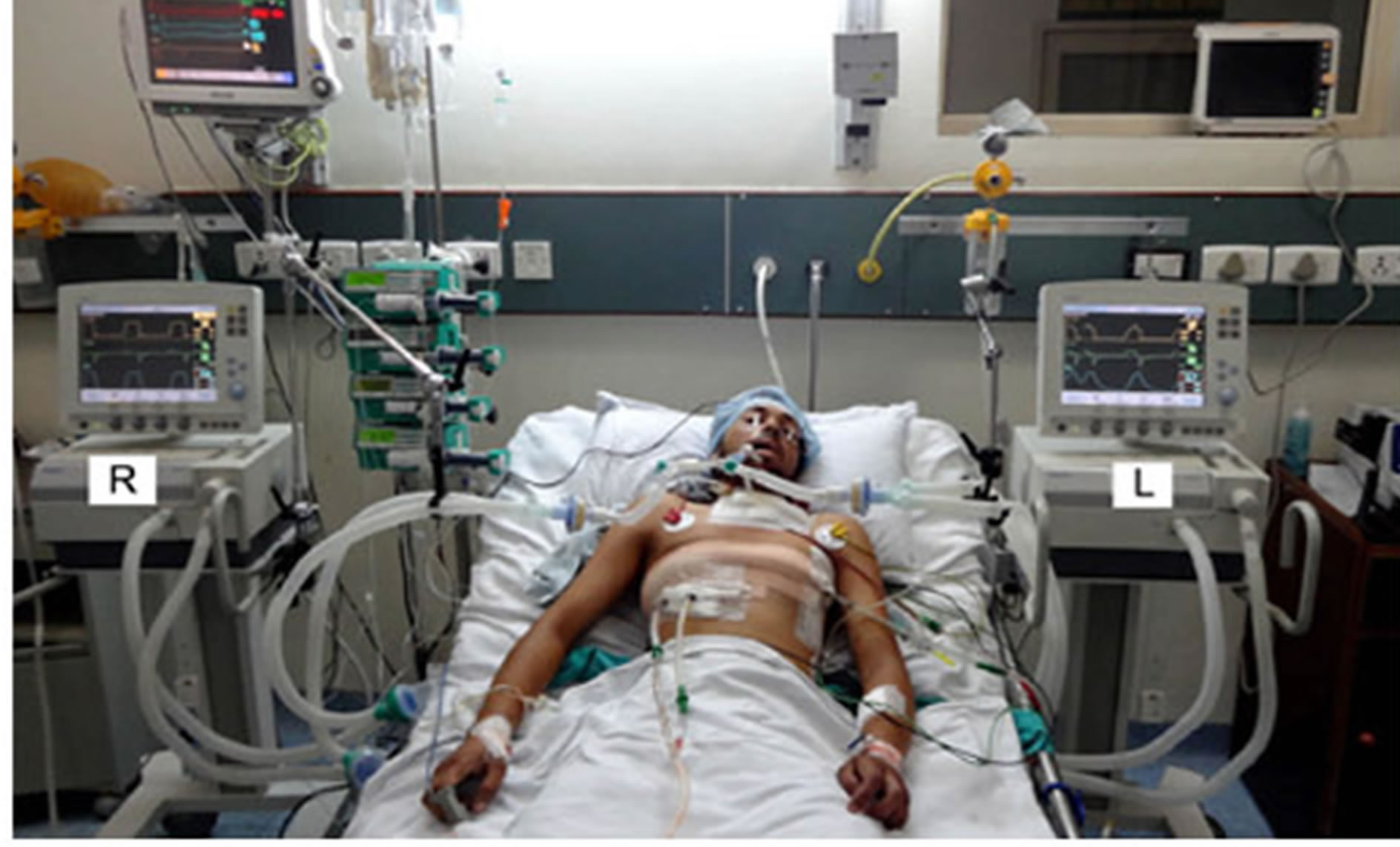 Template meme Hospital patient on ventilator - death