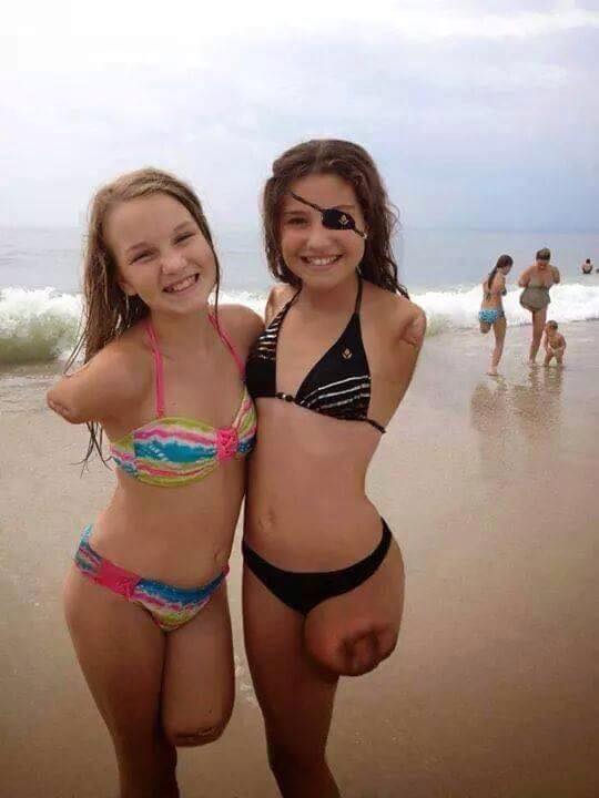 Template meme Memes, amputated girls, shark bite survivors